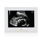 Pearhead Little Blossoms Love At First Sight Sonogram Picture Frame, Ultraound Pregnancy Keepsake, Gender-Neutral Nursery D  Cor
