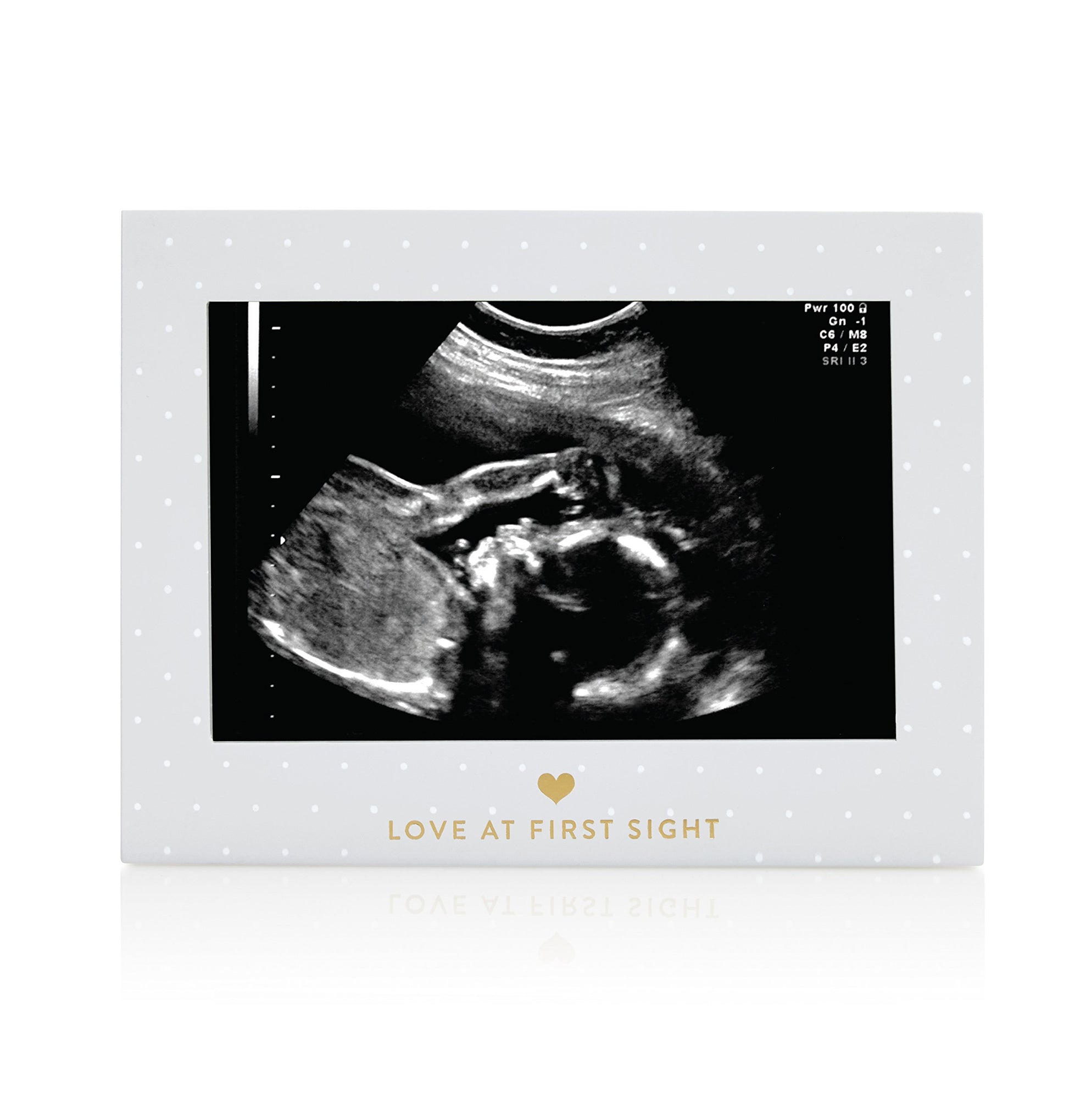 Pearhead Little Blossoms Love At First Sight Sonogram Picture Frame, Ultraound Pregnancy Keepsake, Gender-Neutral Nursery D  Cor