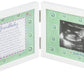 Little Grandbaby Ultrasound Picture Frame/Sonogram Frame, Pregnancy Announcement For Grandparents/New Baby Announcement/Baby Sho