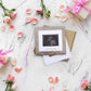 Iheipye Baby Love At First Sight Sonogram Keepsake Frame - Ultrasound Picture Frame - Pregnancy Announcement Frame For Expecting