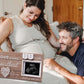 Garybank New Mom Gifts 2024- Love At First Sight Ultrasound Picture Frame, W/ Weekly Pregnancy Milestone Cards & Pregnant Activi
