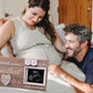 Garybank Love at First Heartbeat Ultrasound Picture Frame, Baby Announcement with Changeable Pregnancy Week Numbers, Pregnancy M